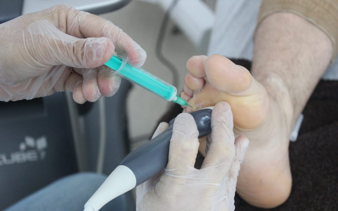 ¡Me han dicho que tengo un Neuroma de Morton!