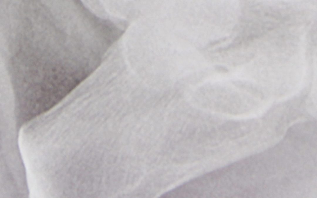 ¿El espolón duele?