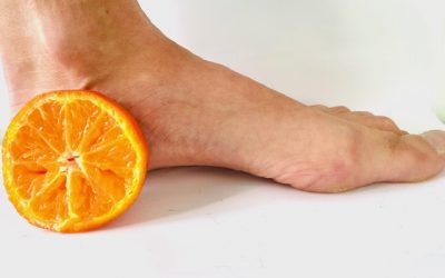 ¡Colágeno, vitamina C y zinc para tu fascitis plantar!