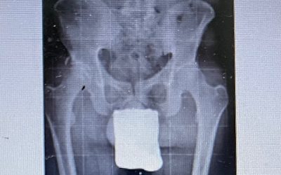 ¡La gran importancia de la pelvis!